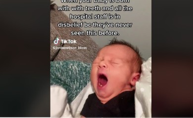 Beba rođena sa zubima, ljekari u nevjerici