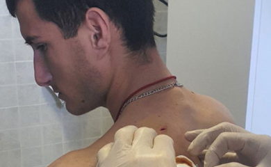 Krivična prijava protiv srpskog mladića kog je izbo Albanac