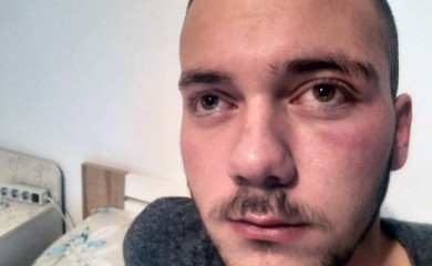 Grupa Albanaca pretukla mladića kada se vraćao sa Božićne liturgije