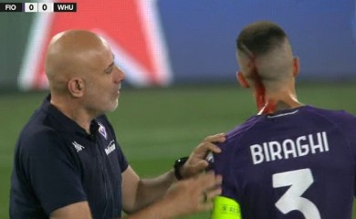 Kapiten Fiorentine krvave glave napustio teren (VIDEO)