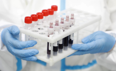 Povraćali krv i imali dijareju: Od nepoznate bolesti umrlo 20 ljudi