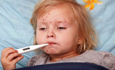 MMR vakcinom vakcinisano 60 odsto djece predškolskog uzrasta: Epidemija malih boginja na pragu