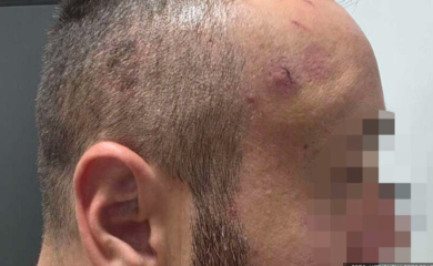 Prva zvanična izjava žrtve policijske brutalnosti u Banjaluci: Prijetili su da će me ubiti i stajali mi nogom na vrat