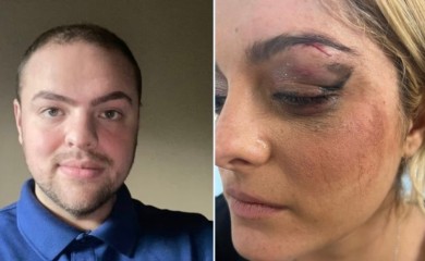 “Bilo je zabavno”: Oglasio se momak koji je razbio glavu albanskoj pjevačici FOTO