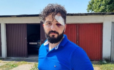 Uhapšene dvije osobe zbog napada na novinara Mirzu Derviševića