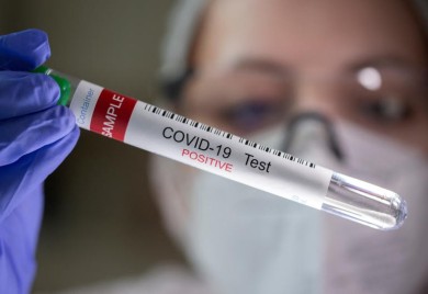 U Srbiji 2.466 novozaraženih, preminulo 11 osoba