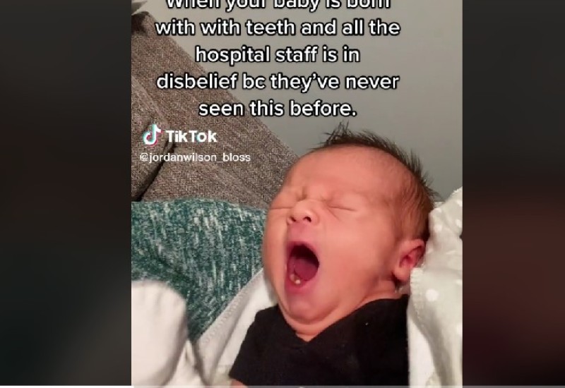 Beba rođena sa zubima, ljekari u nevjerici