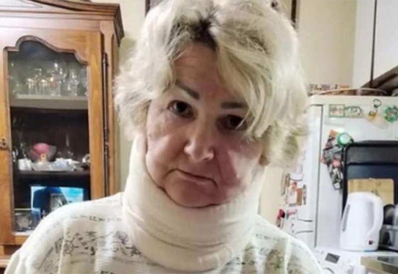 Žrtva brutalnog napada: Ovo je žena koju je pretukao muškarac na pijaci
