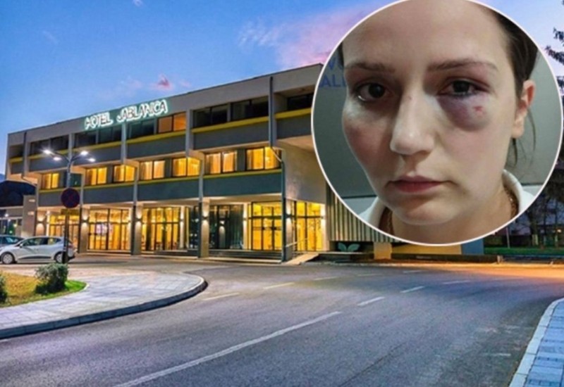 Pretučena radnica uoči protesta: Očekujem veliki broj ljudi, teško se oporavljam