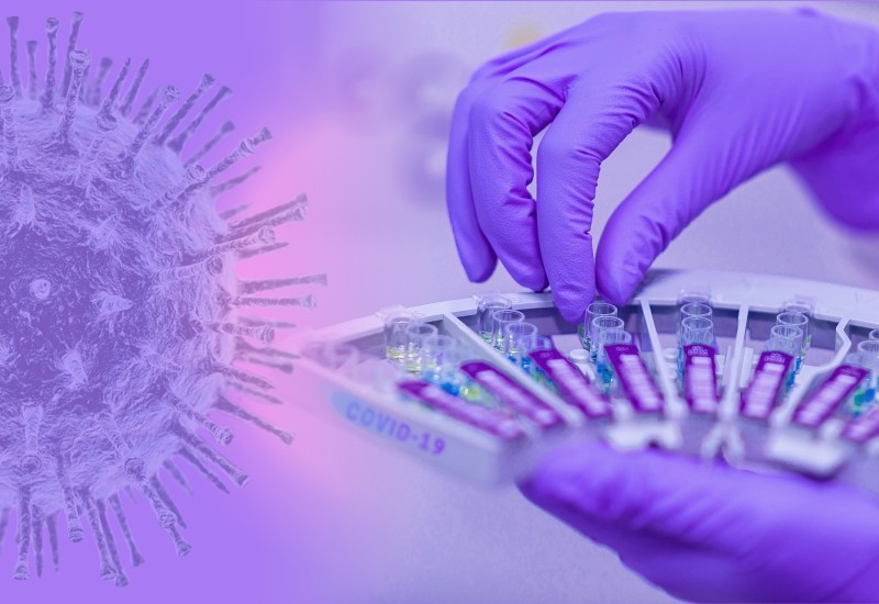 SRBIJA: 1.651 novi slučaj korona virusa, umrlo devet osoba