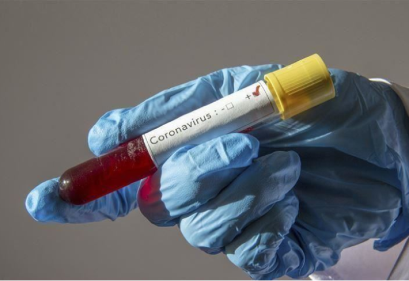 CRNA GORA: Premine dvije osobe od virusa korona