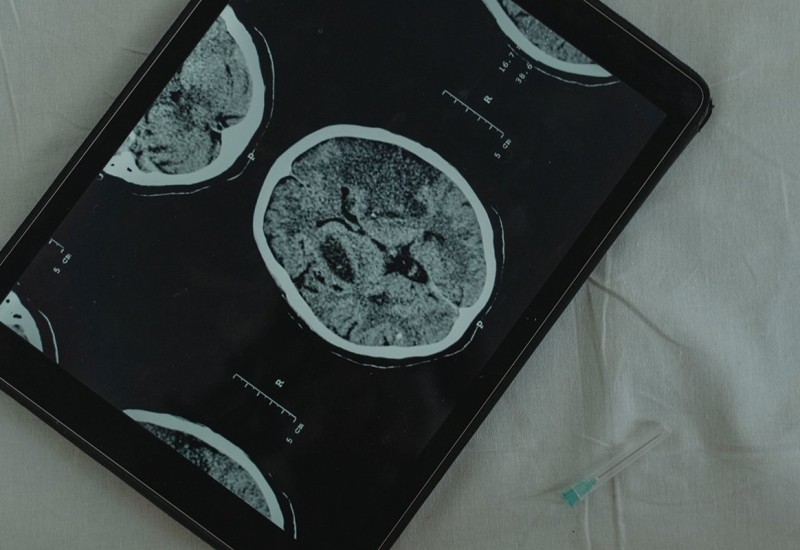 Maskova kompanija će ove godine izvršiti prvu implantaciju moždanog čipa