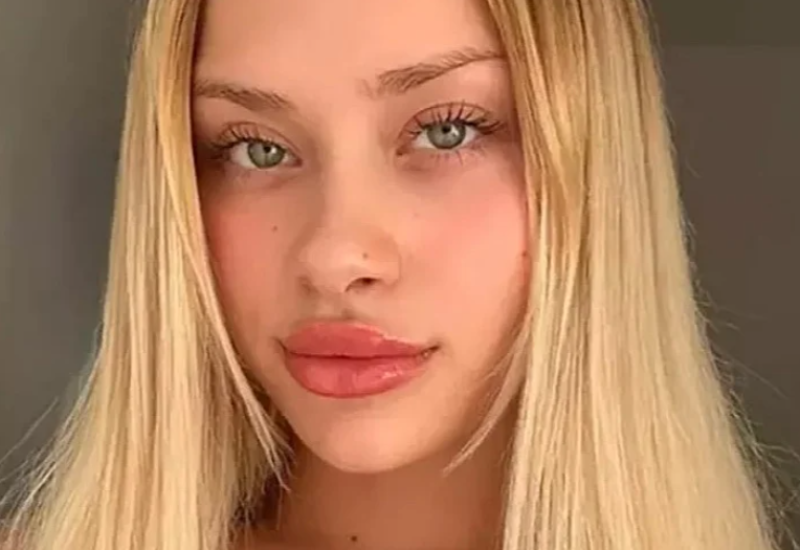 Ukrajinska influenserka pronađena u Dubaiju 10 dana nakon nestanka sa slomljenim udovima i kičmom