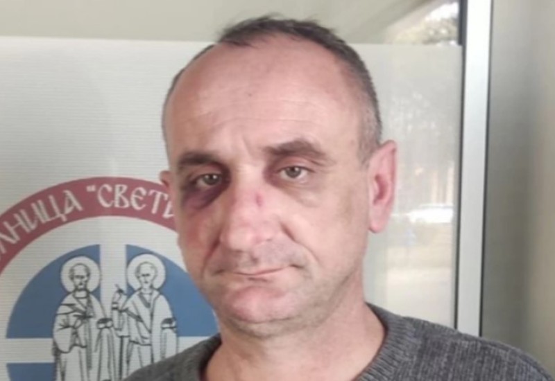 Detalju sukoba aktivista SDS-a! Grujičić: Tanacković me pretukao – ne dam mu dvije funkcije