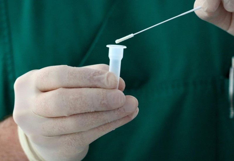 Koronom u Srpskoj u posljednja tri dana zaraženo 40 lica, troje preminulih